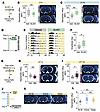 Circadian interventions boost glymphatic flow in healthy mice.