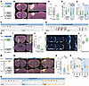 Chronotherapy improves glymphatic function and stroke recovery.