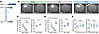Chronotherapy improves stroke outcome in longitudinal MRI.