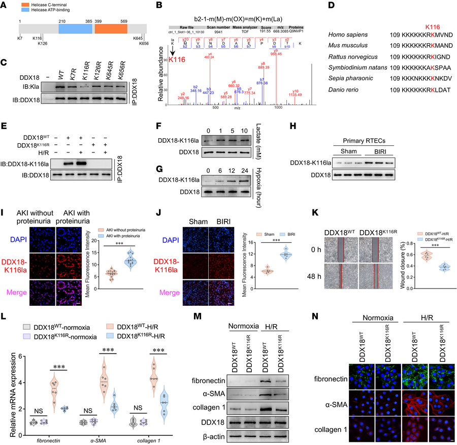 DDX18-K116 lactylation drives the AKI-to-CKD transition in BIRI mice.
(A...