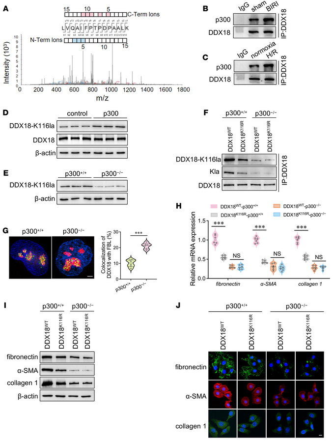 p300 mediates hypoxia-induced DDX18 lactylation, which drives fibrotic r...