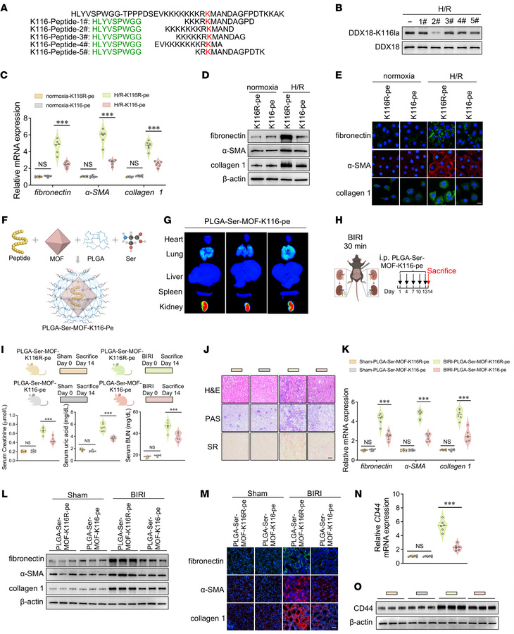 K116-targeted peptide inhibits DDX18 lactylation and attenuates AKI-to-C...