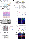 TEC-specific ablation of DDX18 mitigates AKI-to-CKD progression in BIRI mic