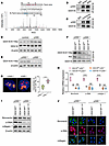 p300 mediates hypoxia-induced DDX18 lactylation, which drives fibrotic resp