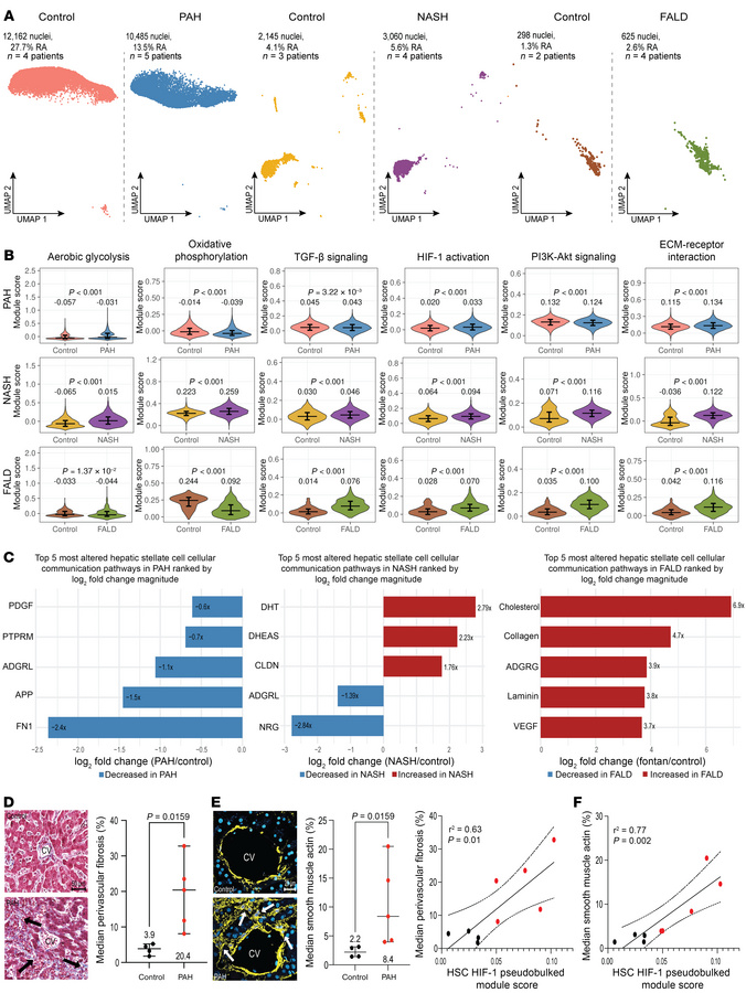 Upregulated HIF-1 and PI3K/Akt signaling characterized HSC signaling in ...