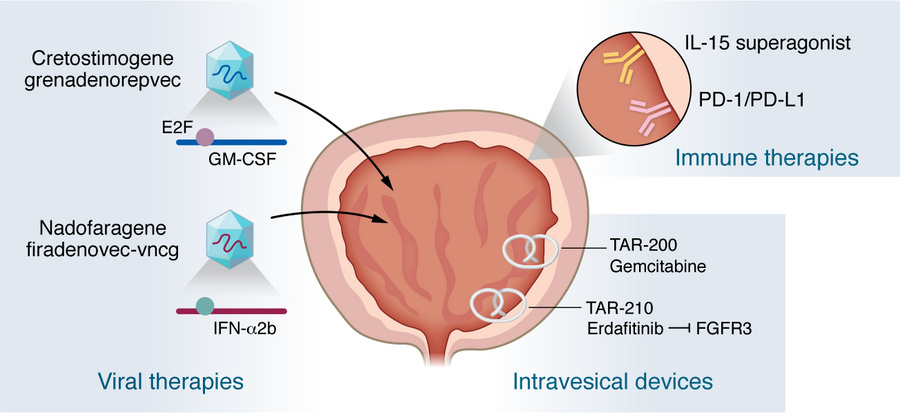 Novel therapies for early-stage bladder cancer.
Multiple new therapeutic...