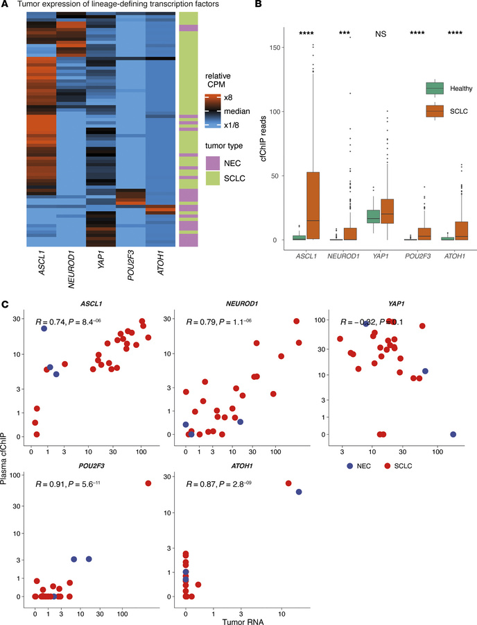 cfChIP-seq displays differential expression of SCLC transcription driver...