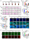 Muscle defects induced by MESH1 overexpression in Drosophila were rescued b