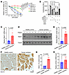MESH1 is upregulated in cancer cachexia and regulates ferroptosis in mammal