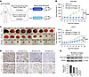 Minnelide reduces tumor growth in human CDS xenograft models.