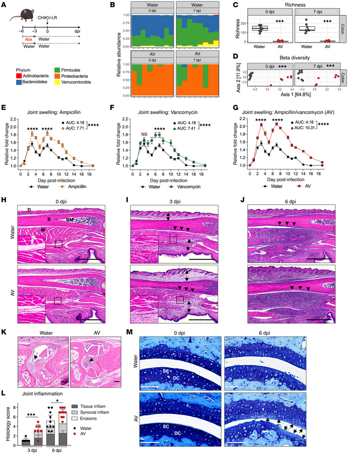 Depletion of the intestinal microbiota by oral antibiotics exacerbates m...