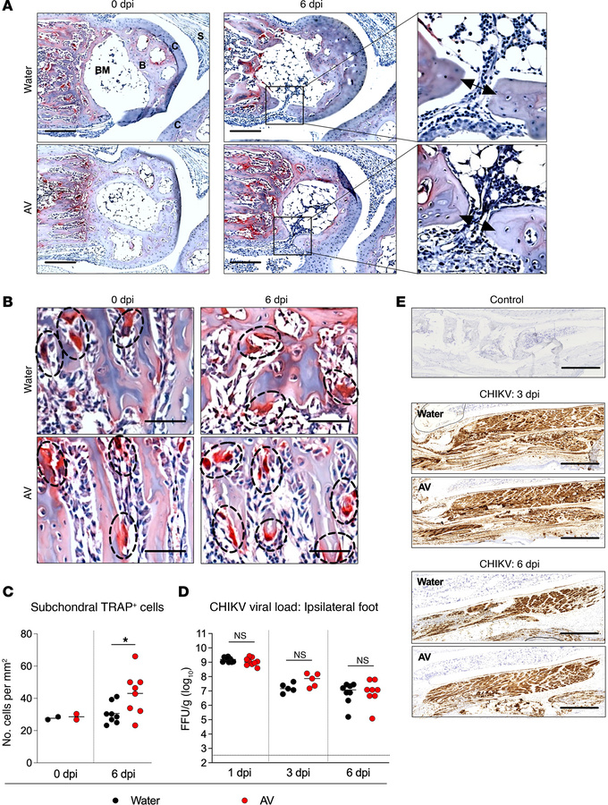 Oral antibiotics increase subchondral osteoclasts without altering viral...