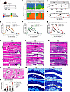 Depletion of the intestinal microbiota by oral antibiotics exacerbates musc