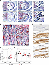 Oral antibiotics increase subchondral osteoclasts without altering viral in
