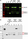 Immunoblot investigations of plasma high-molecular-weight kininogen on Keny
