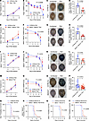 Characterization of P. berghei ANKA infection in HK- and bradykinin recepto