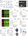 Studies with conditional KO mice of brain microvascular endothelial cell.