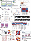 Spatial structures influence the efficacy of apatinib in SNF4 HR+/HER2– bre