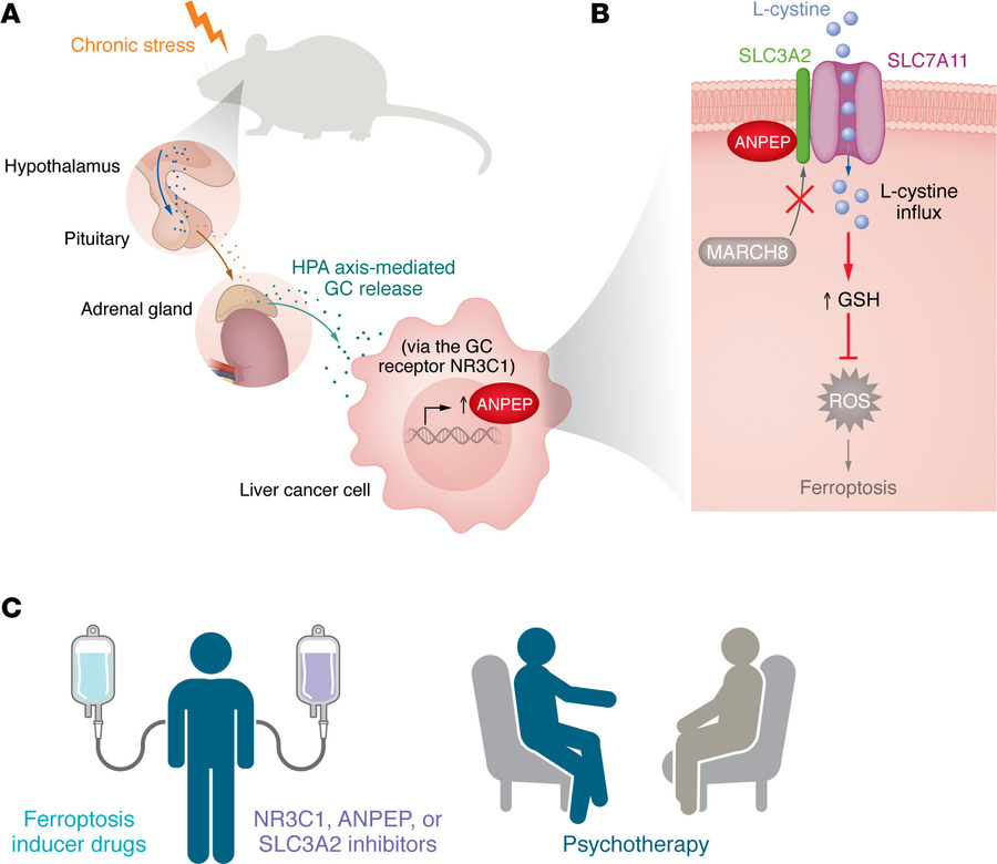 Chronic stress–induced ANPEP drives ferroptosis resistance in liver canc...