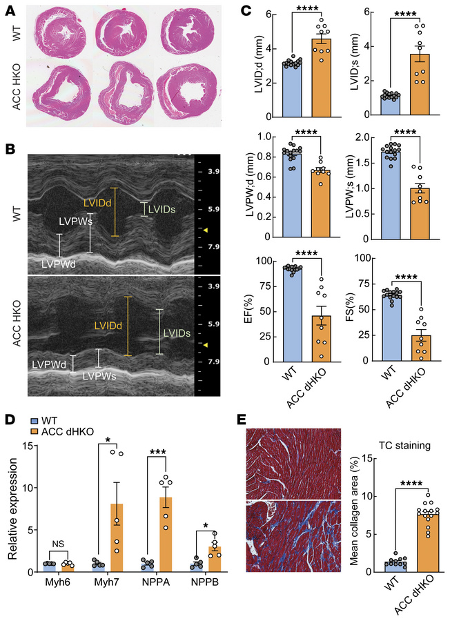 Decreased heart function in ACC dHKO mice.
(A) Transverse/2-chamber view...