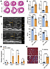 Decreased heart function in ACC dHKO mice.
