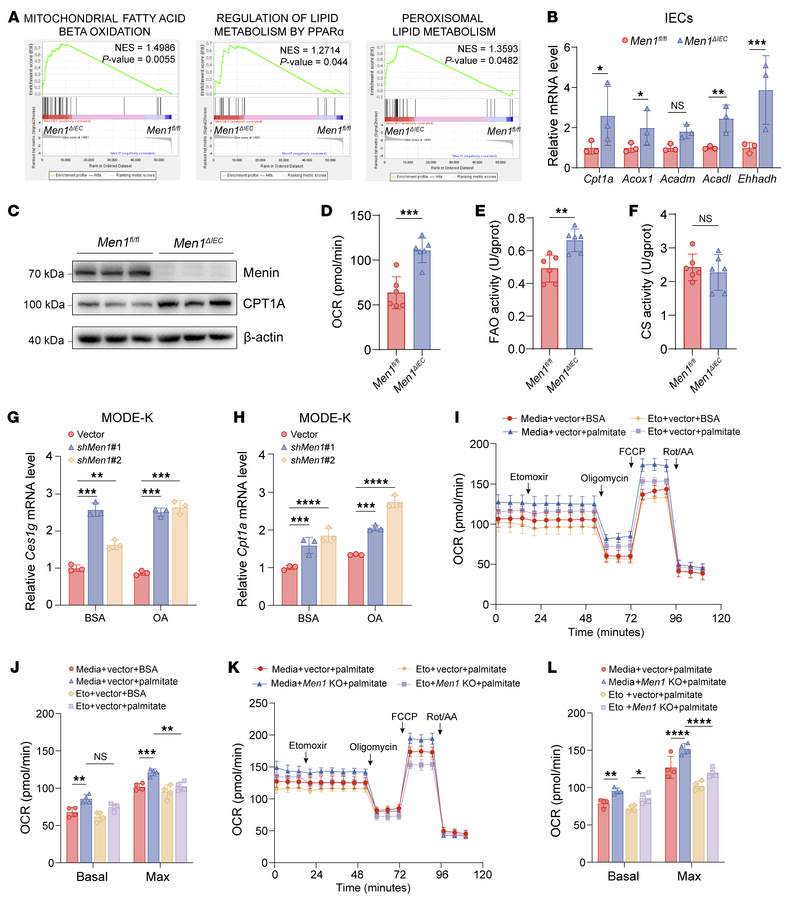 
Men1 deficiency enhances FAO capacity in IECs.
(A) Gene set enrichment ...