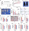 IEC-specific Men1 deletion attenuates HFD-induced weight gain in mice.