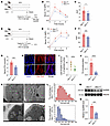 Men1 deletion in IECs reduces chylomicron formation.