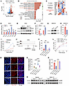 Men1 deletion upregulates Ces1g expression in IECs, driving lipolysis and c