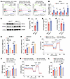 Men1 deficiency enhances FAO capacity in IECs.