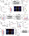 Pharmacological or genetic inhibition of intestinal menin attenuates HFD-in