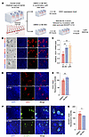 MI-463 administration enhances CES1 expression and reduces lipid accumulati