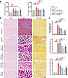 UA-30 treatment alleviated muscle damage and suppressed muscle pathologic d