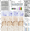 Mdivi-1 eliminated the beneficial effects of UA-30 on motor neuron loss and