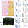 Mdivi-1 attenuated UA-30–induced improvement in motor function.
