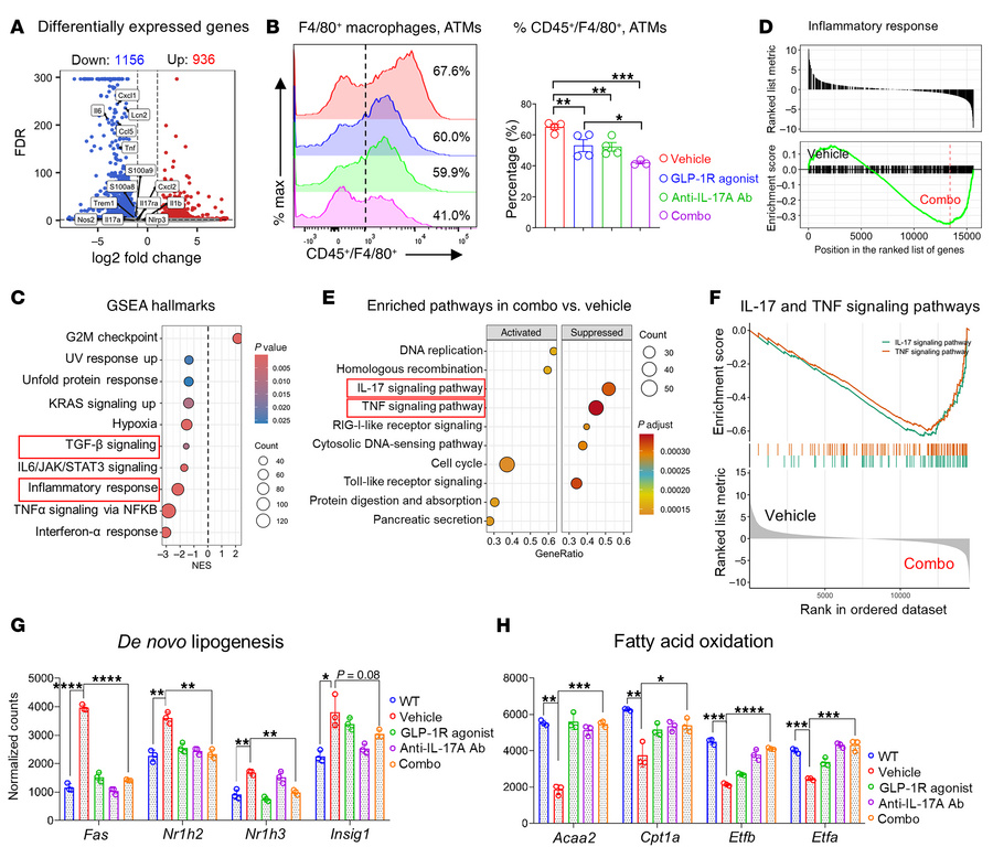 Combination of GLP-1R agonist and anti–IL-17A antibody therapy reverses ...