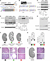 Humanized PKD1 5′UTR mouse model with or without PKD1 uORFs.