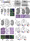 PKD1 ΔuORF1&2 rescues cystic kidney models from the Pkd1RW missense allele.