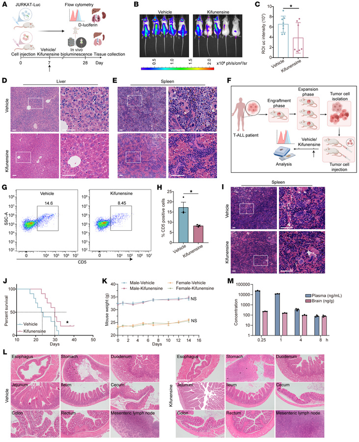 Inhibition of N-glycosylation with kifunensine attenuates Notch-dependen...