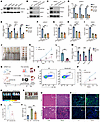 DOCK2 KO attenuates Notch signaling–dependent leukemia invasion, migration,