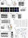 DOCK2 regulates NCSTN intracellular trafficking via N-glycosylation.