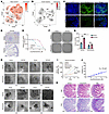 Inhibition of DOCK2-mediated NCSTN N-glycosylation by the α-mannosidase inh