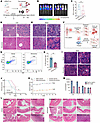 Inhibition of N-glycosylation with kifunensine attenuates Notch-dependent l