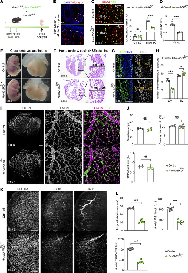 Endocardial deletion of Hand2 caused defective cardiovascular developmen...