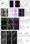 Endocardial deletion of Hand2 caused defective cardiovascular development.