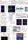 Bulk and single-cell RNA-Seq analysis in Hand2-EKO hearts revealed decrease