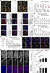 Hand2 deficiency in endothelium elevated hypoxia signaling and enhanced tip