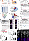 Hand2 coordinated TGF-β MAPK/p38 pathways control EC migration and artery f