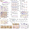 AHCY deficiency of erythroblast results in the generation of nonerythroid l