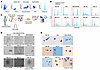 Reduced H3K4me3 level of erythroblasts leads to the generation of progenito